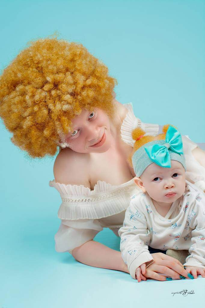 The new standard of beauty.
#albinismisbeautiful 
#Albinismrising 
#albinismawareness 
Photo: Unknown