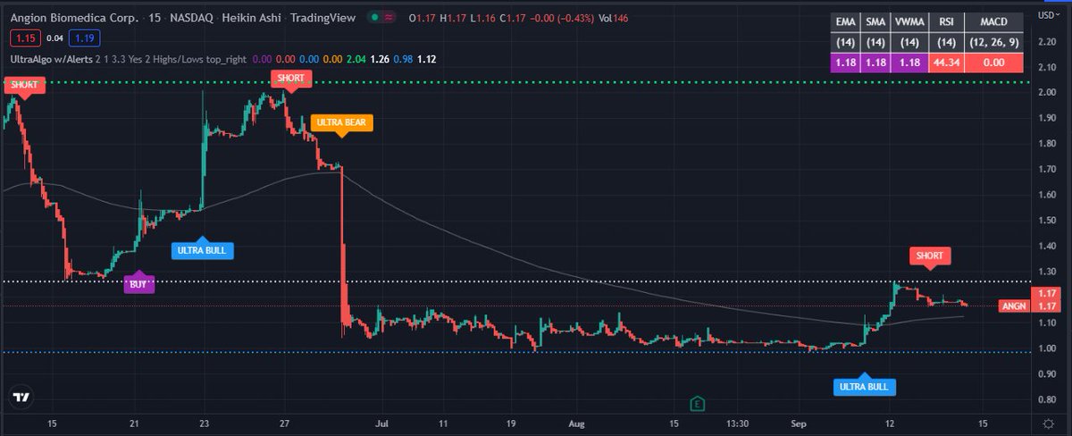 TradingView Chart for Angion Biomedica Corp
