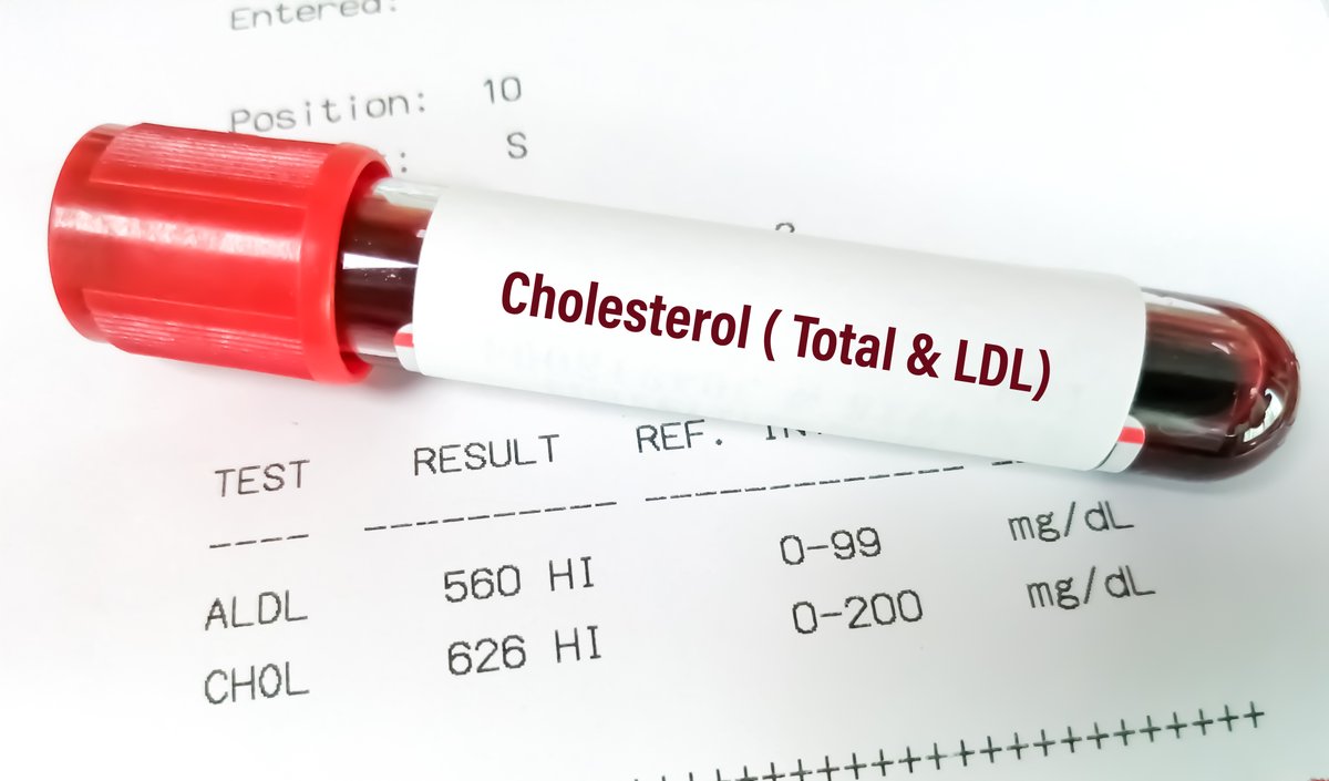 Getting your cholesterol checked AT LEAST every 5 years (sooner with certain risk factors) is essential for living a healthy life. Even more important - knowing what those numbers MEAN. Learn more at the link below and talk to our team about any questions you have!  ...