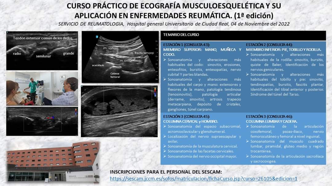 MarcoReudol's tweet photo. 1er Curso de ecografía musculoesquelética y su aplicación en las enfermedades reumáticas dirigido a todas las especialidades y niveles de atención.
Os invitamos a participar:
https://t.co/Rcc1aOj3Kz https://t.co/QaXESeW1e7