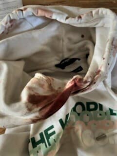 Lebienpublic's tweet image. #Dijon : nouvelle agression gratuite place de la République. Deux étudiants passés à tabac « sans aucune raison ».
c.bienpublic.com/faits-divers-j…