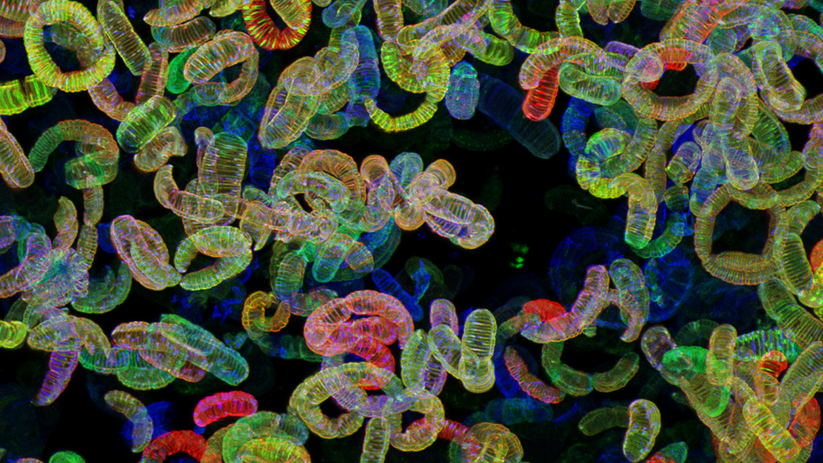 NatureComms's tweet photo. New featured image on our homepage!
https://t.co/zp4DaeQLq6

Related to:

Evolution of longitudinal division in multicellular bacteria of the Neisseriaceae family

https://t.co/p0bmoDPZYH

@bulgheresi_s @VeyrierFrederic @BrunLabCaulo @CavaLab_MIMS @Archaea_Vienna @vielifesciences https://t.co/XUsn1aeFxs