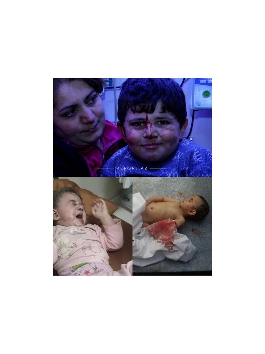 bayyramli's tweet photo. Bu uşaqları nə vaxt unutdun ey Dünya? 

#StopArmenianAggression #StopArmenianTerror #SəngərdəƏsgərSosialdaBiz https://t.co/Q37IaItMXn