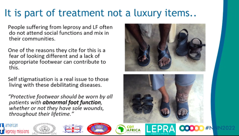 NTD_NGOs's tweet photo. At #NNN2022 W3.2 we learn how footcare is relevant to #DisabilityPrevention for #NTDs &amp; #Diabetes with opportunities to optimise resources, 📈 capacity, ultimately improving health &amp; psychosocial outcomes for patients while reducing costs related to complications. #BeatNTDs https://t.co/Qhx667rN4p