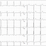 Photo by ECG Cases (@ecg_cases)