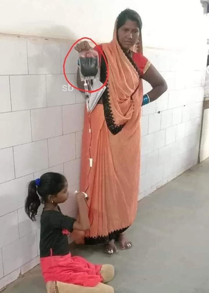 जिस देश में सरकार को हॉस्पिटल,शिक्षा,रोज़गार से ज़्यादा मूर्तियाँ,शहरों के नाम बदलने में ज़्यादा दिलचस्पी हो उस देश-प्रदेश में ऐसे ही नज़ारे देखने को मिलते हैं…