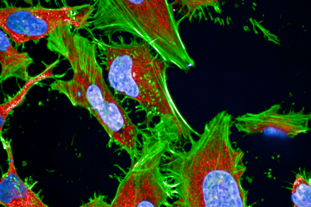 Inria_Saclay's tweet photo. Biologie numérique 💊 | La fabrication de médicaments est un processus complexe. Un partenariat de recherche entre @Inria et @Servier a abouti au développement de modèles et d'outils numériques pour rendre ce cheminement plus sûr et plus court. 

➕ https://t.co/e1JwuG7UQ5 https://t.co/BoxvJvKG85