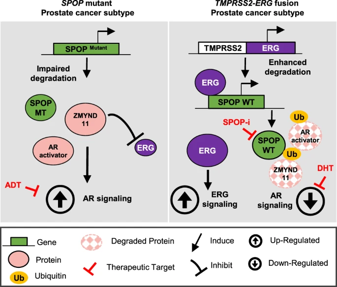 DrYukselUrun's tweet photo. 🧬SPOP mutations were associated with improved outcomes to ADT+androgen receptor-axis-targeted therapies (but not ADT plus docetaxel) in de novo mCSPC 
🔶Treatment selection for mCSPC might be chosen accordingly!
@umangtalking @OncoAlert #prostatecancer 
https://t.co/yZWQzxew7h https://t.co/hkc1ppCEg8