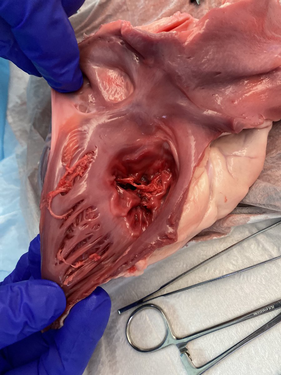 CCF School of Cardiac Ultrasound tweet media