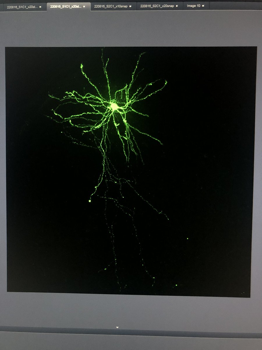 brinda_341's tweet photo. Hello #imaging twitterers, today looks like me being sat miserably in the dark room but I have neurons from last month like these to keep me company. 🤩 https://t.co/6qxEmk3rWy