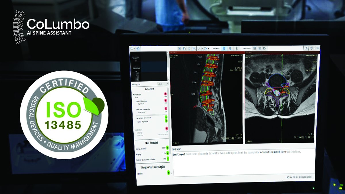 Smart Soft Healthcare is honoured to announce that CoLumbo AI spine assistant software received an ISO13485:2016 certification!
bit.ly/3xq0Lcf