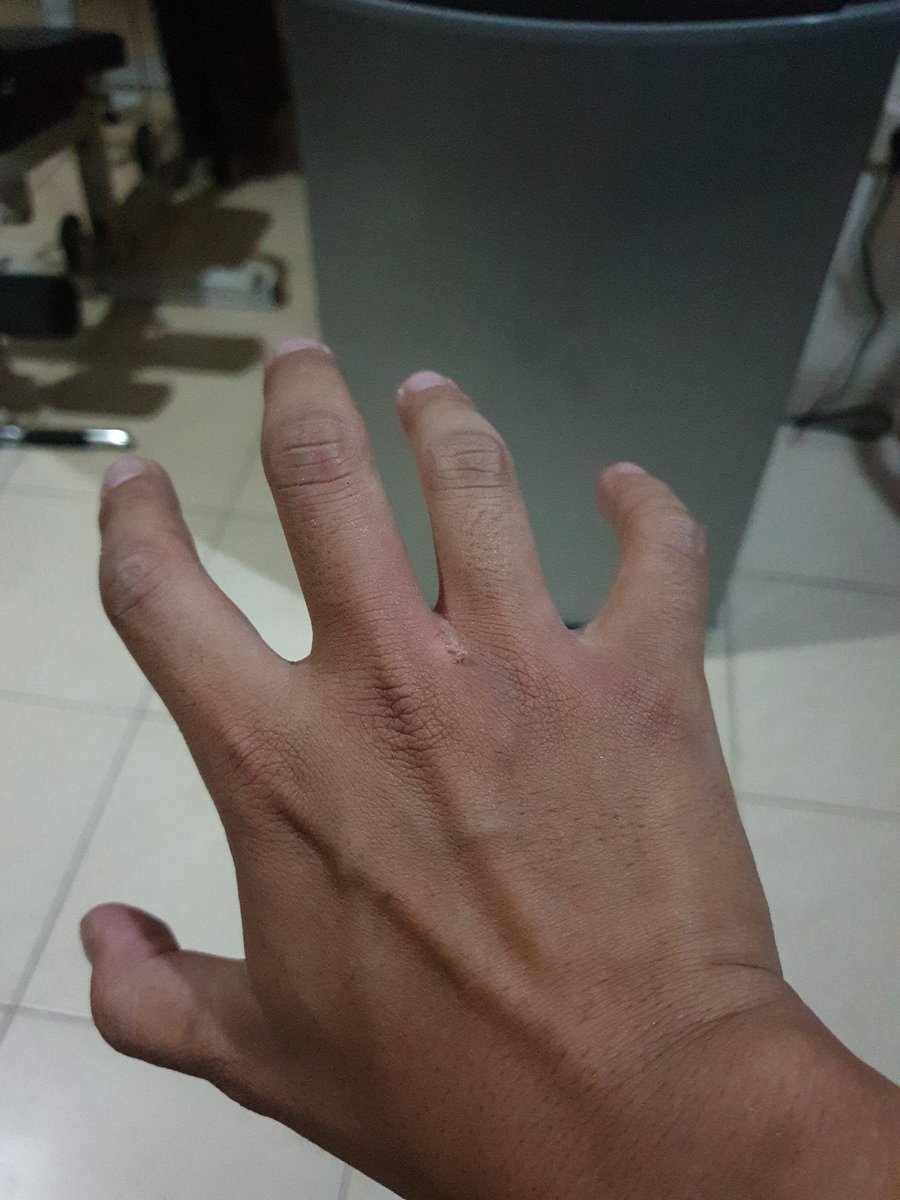 Untung gak patah nih jari