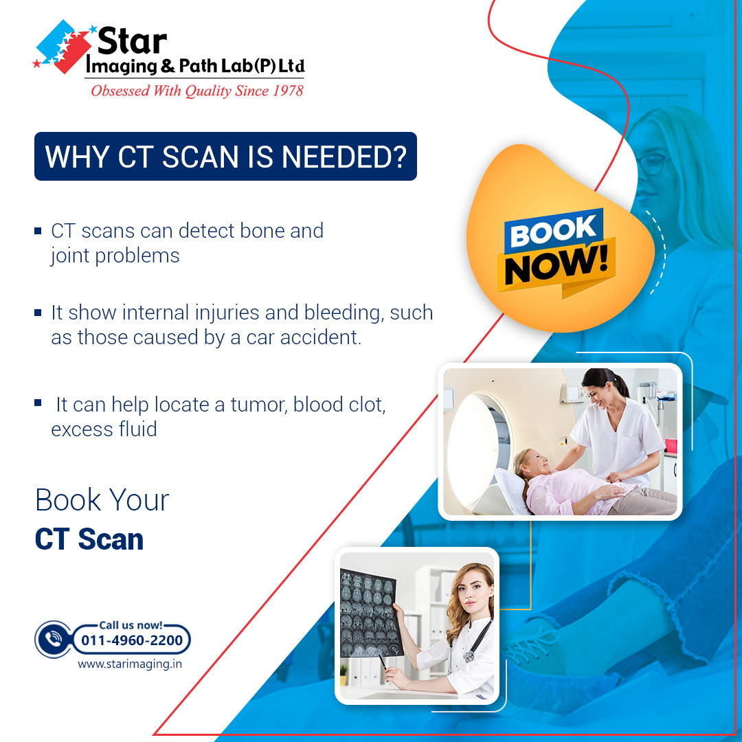 StarImaging_'s tweet photo. Star Imaging and Path Lab Providing Advance CT Scan Services in Delhi Get High-Resolution and Better Image Quality.
Book Ct Scan Now at- 011-45602200 or Visit:- https://t.co/6UND8JEskz
#StarImagingandPathLab #CTScan #CTScanNearMe #CTScanCost #CTScanPrice #CTScanCharges https://t.co/r1pdgEXnEj