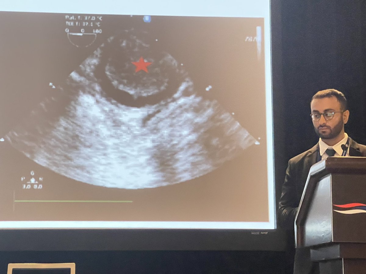 FOAMecmo's tweet photo. #POCUS &amp; #ECMO??
🖥 pre-ECMO assessment; identifying or confirming pathology, rule out complications, assist cannulation
🖥 intra-ECMO assessment: troubleshooting flows + evaluating readiness to wean from #ECLS
🖥 post-ECMO assessment
@adalia513 #ELSO2022 https://t.co/lMGIPVuPpk