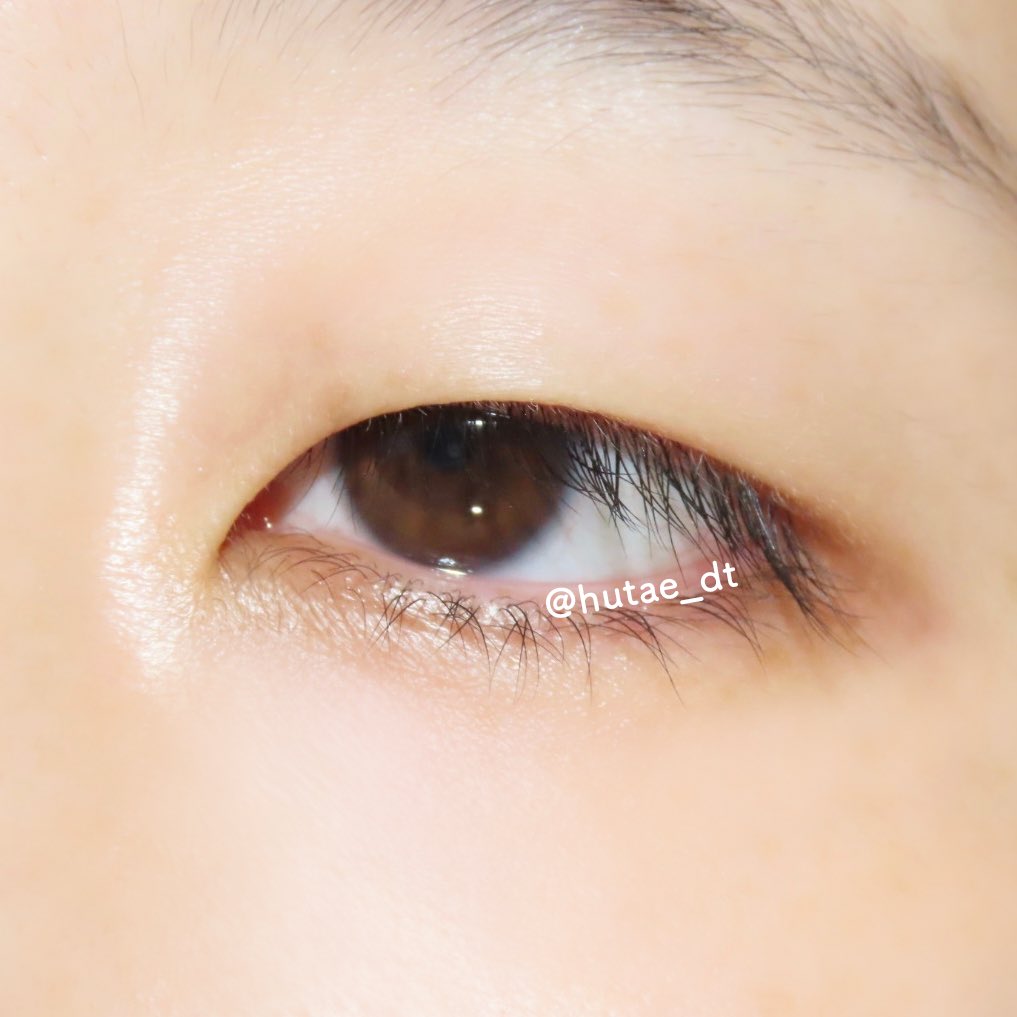 hutae_dt's tweet photo. 二重全切開と目頭切開
ビフォアフ

まつ毛がちゃんとカールキープされるようになったし、薄めにメイクしてもいい感じに仕上がるようになった👀✨

まつげの根元が見えるだけでだいぶ印象違う🫶個人的には中顔面が短く見えるようになったのがすごく嬉しい🫧 https://t.co/VUAJLAlEaX