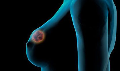 xmipink's tweet photo. No esperes a octubre para cuidar tu salud.
El cáncer de mama es cosa de todos.

SIN RADIACION
SIN BARRERAS DE EDAD
SIN DOLOR

https://t.co/WNRW7lzSrg https://t.co/knWbvNFwO4