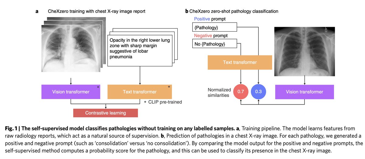 Pranav Rajpurkar tweet media