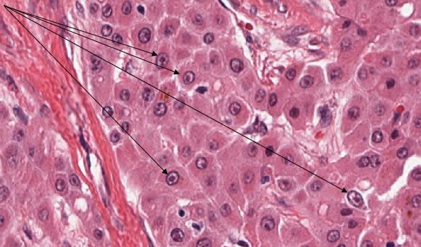 Beaumont, Royal Oak - Pathology Residency tweet media