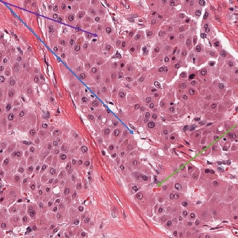 Beaumont, Royal Oak - Pathology Residency tweet media