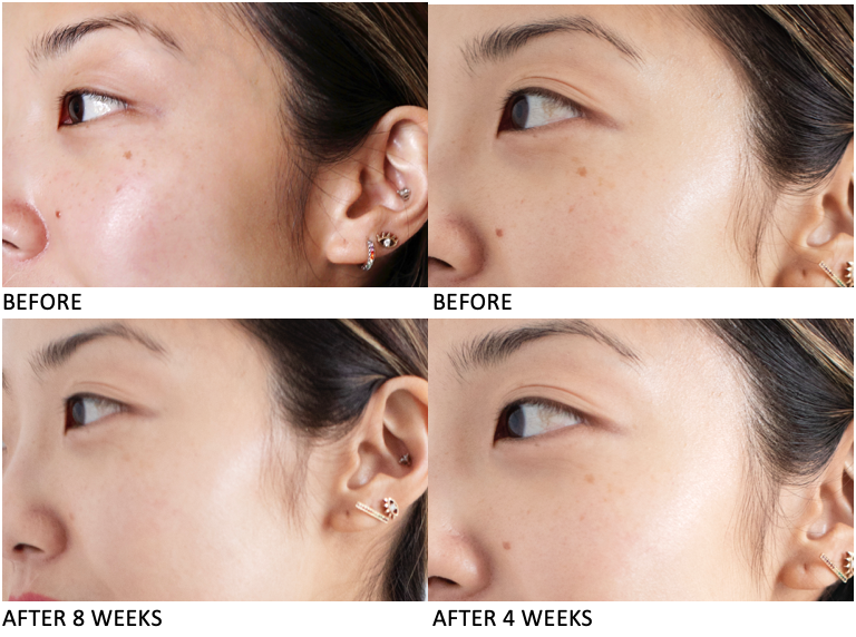 sosweeteye's tweet photo. 😍Kiehl's Clearly Corrective Dark Spot Solution (พร้อมกล่อง) 
เซรั่มลดจุดด่างดำ บอกลาความหมองคล้ำ  พร้อมปรับผิวให้กระจ่างใส กระชับรูขุมขน ให้ผิวเรียบเนียน 

50 ml 1,190 จาก 3850 บาท
100ml ฿3,290 จาก 4335บาท

สั่งซื้อ https://t.co/SIeNAJBCtd

#เซรั่ม #เซรั่มKiehls https://t.co/KYTc7kYKBi