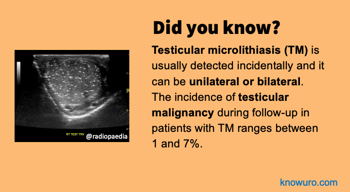 Hello #urology #residents! Have you studied testicular microlithiasis yet? Here are some UROfacts. To learn more, here is a really nice review article: bit.ly/3Ublquh 🌟 1/2🧵 #testicularcancer #urologia