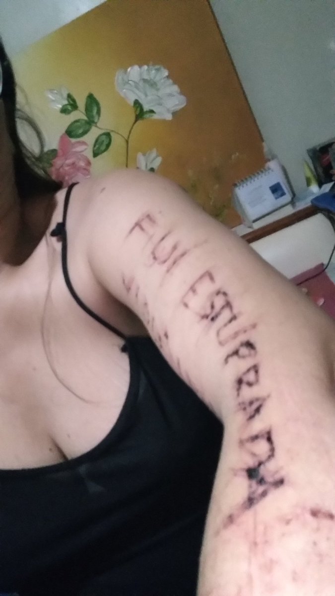 Vitimadeestupro's tweet photo. Sofri #violênciaSexual e a justiça tem sido dura comigo.
@souvitimaa @EDMpelaMulher  @Vitimadeestupro @EDMpelaMulher @perguntasverd  @luana48318853 @Nao_Ao_Abuso @perguntasverd @AoEstrupoNao @de @CULTURA_ESTUPRO @retwuiters @violentadas @naoehnao #automutilação #dornaAlma https://t.co/tBfahx0OQq