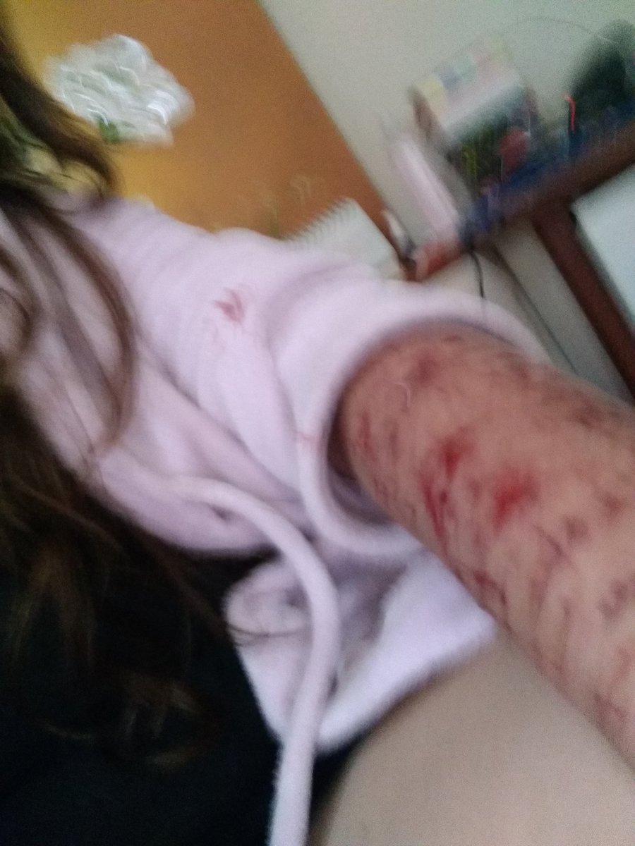 Vitimadeestupro's tweet photo. Sofri #violênciaSexual e a justiça tem sido dura comigo.
@souvitimaa @EDMpelaMulher  @Vitimadeestupro @EDMpelaMulher @perguntasverd  @luana48318853 @Nao_Ao_Abuso @perguntasverd @AoEstrupoNao @de @CULTURA_ESTUPRO @retwuiters @violentadas @naoehnao #automutilação #dornaAlma https://t.co/SoTZN4N7Fg