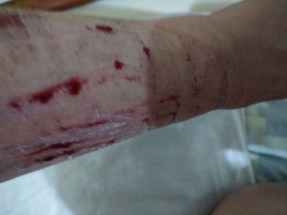 Vitimadeestupro's tweet photo. Sofri #violênciaSexual e a justiça tem sido dura comigo.
@souvitimaa @EDMpelaMulher  @Vitimadeestupro @EDMpelaMulher @perguntasverd  @luana48318853 @Nao_Ao_Abuso @perguntasverd @AoEstrupoNao @de @CULTURA_ESTUPRO @retwuiters @violentadas @naoehnao #automutilação #dornaAlma https://t.co/D3G7UUGRmP