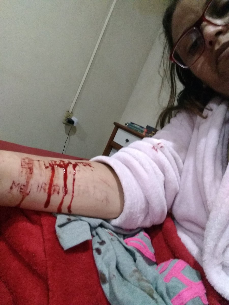 Vitimadeestupro's tweet photo. @secdhbel Sofri #violênciaSexual e a justiça tem sido dura comigo.
@souvitimaa @EDMpelaMulher  @Vitimadeestupro @EDMpelaMulher @perguntasverd  @luana48318853 @Nao_Ao_Abuso @perguntasverd @AoEstrupoNao @de @CULTURA_ESTUPRO @retwuiters @violentadas @naoehnao #automutilação #dornaAlma https://t.co/1cSsvRDQ5m
