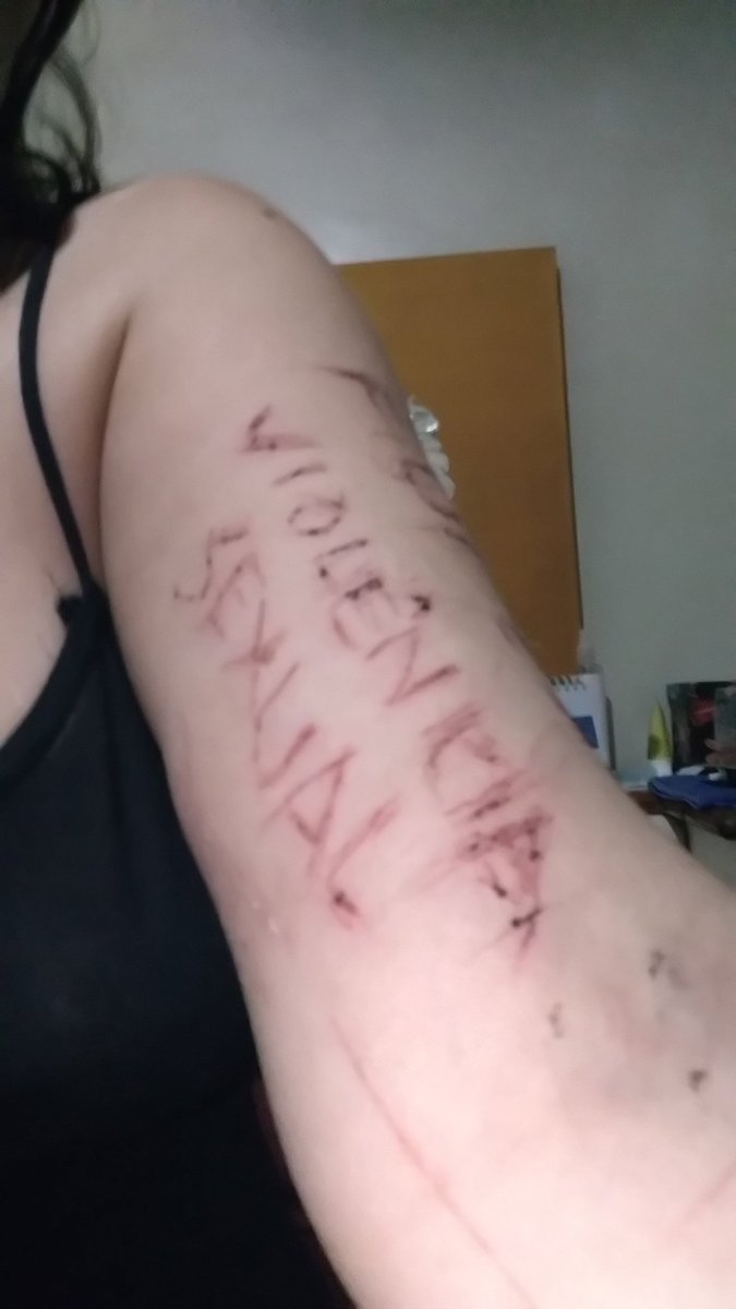 Vitimadeestupro's tweet photo. @secdhbel Sofri #violênciaSexual e a justiça tem sido dura comigo.
@souvitimaa @EDMpelaMulher  @Vitimadeestupro @EDMpelaMulher @perguntasverd  @luana48318853 @Nao_Ao_Abuso @perguntasverd @AoEstrupoNao @de @CULTURA_ESTUPRO @retwuiters @violentadas @naoehnao #automutilação #dornaAlma https://t.co/1cSsvRDQ5m