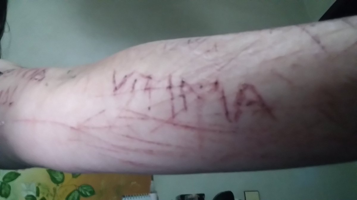 Vitimadeestupro's tweet photo. @eshoje Fui estuprada e a justiça está levando mais de 2 anos, daqui pouco 3.... Isso está me destruindo!
#FuiEstuprada #Estuprada #EstuproES https://t.co/ERFAITOMoQ
