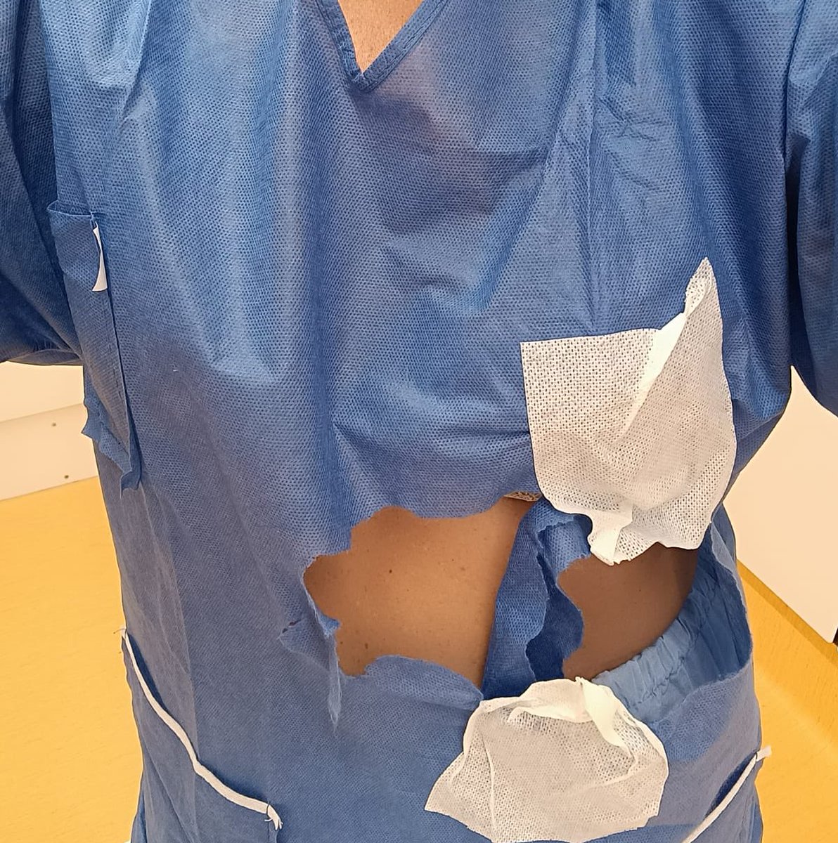 PersonalPSMar's tweet photo. Poc demanem davant reiterats menyspreus, però si us plau, es tan difícil dotar a la plantilla d’uniformes que no cal ens dignifiquin, val que no es desfacin després d’una guàrdia @UrgenPSMar https://t.co/n0Mc31eBPY