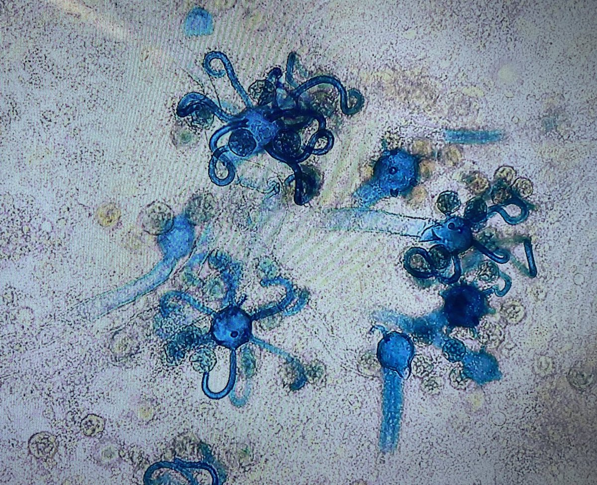 Henry Ford Hospital Infectious Diseases Fellowship tweet media