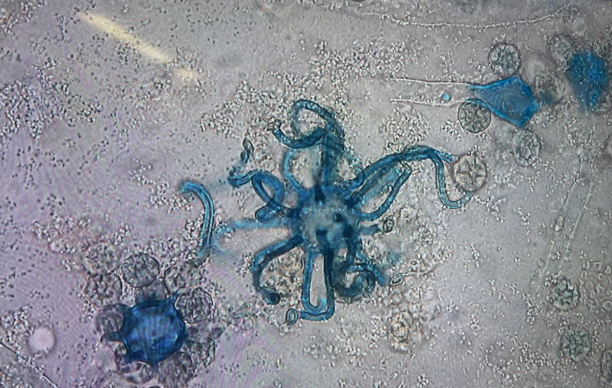 Henry Ford Hospital Infectious Diseases Fellowship tweet media