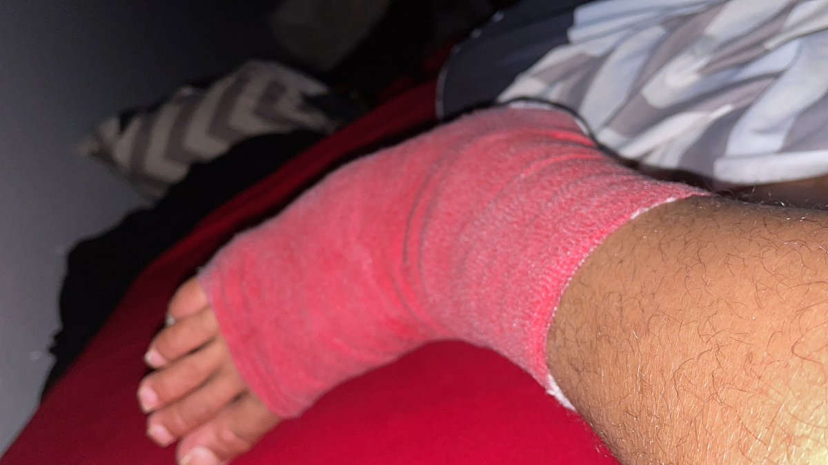 KPUpNextt's tweet photo. @pulte I’m in a cast for my foot can’t really work or move anything would help 🥺🙏🏽 $SoAntiiA https://t.co/Vvs8WHA8ZG