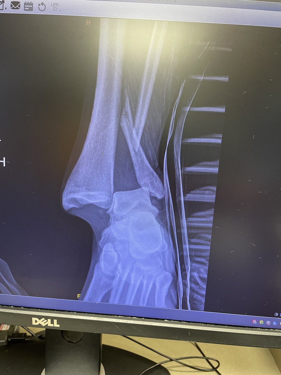 Cal Robinson tweet media