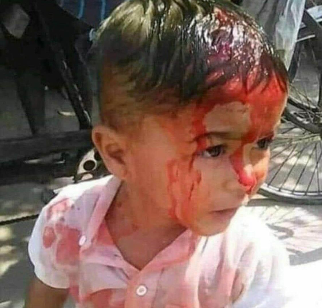 SimaKazim17's tweet photo. War is very scary, but the worst thing is the death of children In 2020, Armenians 9 bombed quiet cities outside the war zone, where innocent children died, and the world turned a blind eye to it.
#StopArmenianAggression
#StopArmenianTerror
#DontBelieveArmenia
#strongaz https://t.co/yNNKzdHJjz