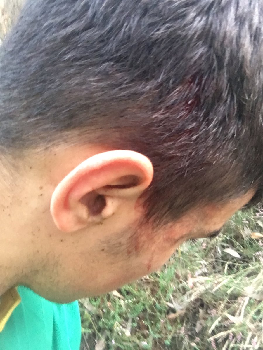 Xa fai un ano que arregeli a cabeza ahora todo e mellor😏