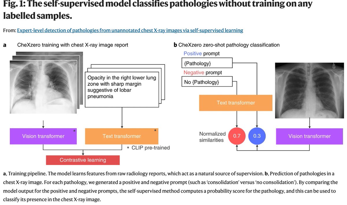 Isaac Kohane tweet media