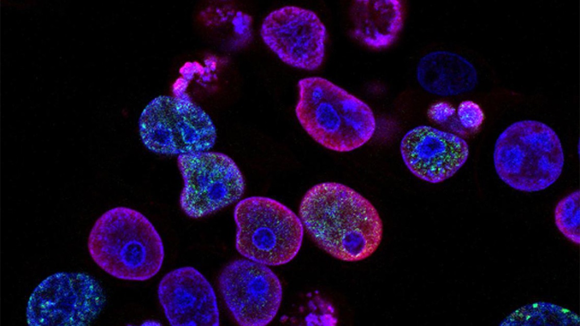 University of Toronto (@uoft) on Twitter photo Researchers from <a href="/UTM/">U of T Mississauga</a> explore use of light-activated treatment to target wider variety of cancers #UofT 🔬 uoft.me/8ik Researchers from <a href="/UTM/">U of T Mississauga</a> explore use of light-activated treatment to target wider variety of cancers #UofT 🔬 uoft.me/8ik