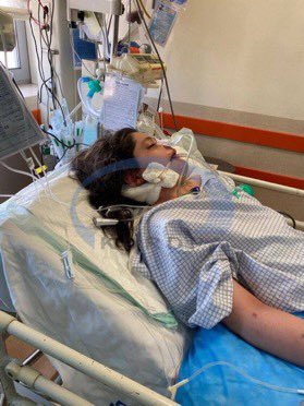 This young Iranian girl,
#Mahsa_Amini, was savagely attacked by the morality police and is now in coma for not wearing “proper hijab”. Ladies and gentlemen, no matter how #IranLobby in Washington DC sugarcoats this regime, Iranian women have been going through a gender apartheid