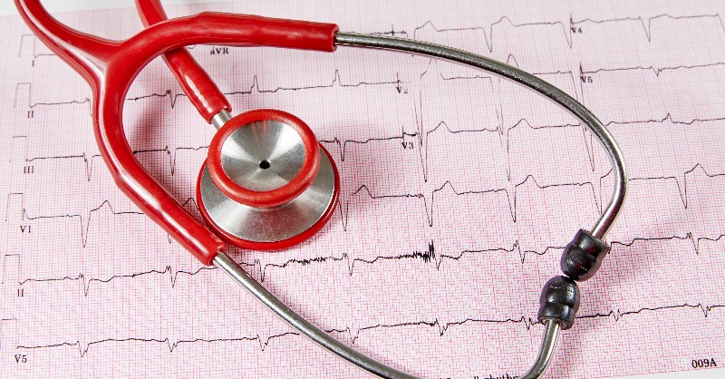 CedarsSinai's tweet photo. "This is the first study to show an actual flip in the risk of atrial fibrillation," said Dr. @CMAlbertEP, head of cardiology at the Smidt Heart Institute at Cedars-Sinai.
