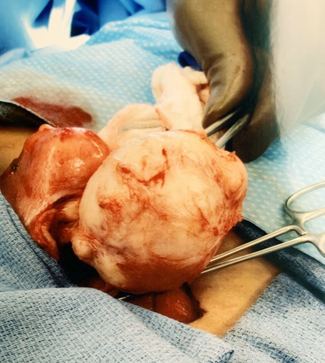 UniversalSurge1's tweet photo. ET #host #Nischelle Turner on her 3 fibroid surgeries: 'You start to feel like #damaged #goods'
As a teenager, Entertainment Tonight co-host Nischelle Turner thought heavy, painful periods were normal. 
share your knowledge at https://t.co/OEhekoMqZI
#ipjus
#USA https://t.co/fbMLF4ij0E