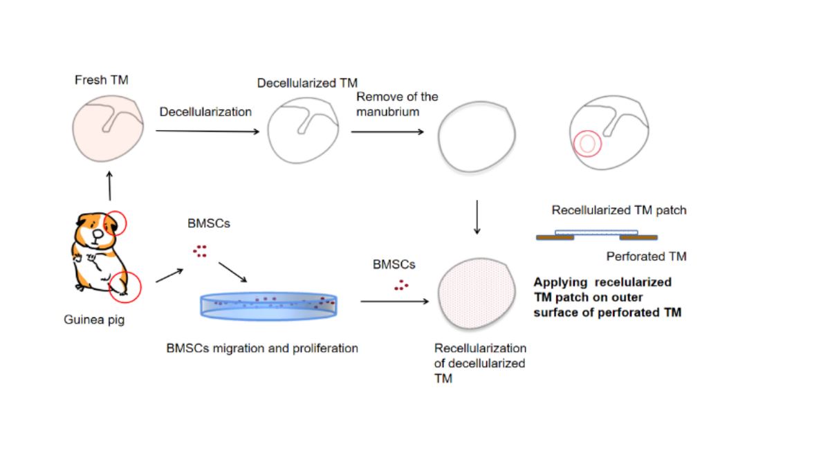 ArtifOrgans's tweet image. #Decellularized #TympanicMembrane Scaffold with #BoneMarrow Mesenchymal #StemCells for Repairing Tympanic Membrane Perforation
#OnlineFirst👉bit.ly/3BLXrLh
#Chengdu🇨🇳| #TissueEngineering