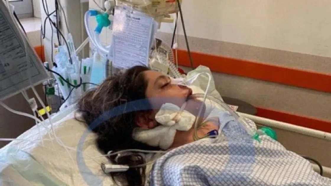 swati_gs's tweet photo. Mahsa Amini, a 22-year-old woman from Iran was in Tehran with her family. She was detained by morality police for not wearing #hijab. Two hours later, she had to be hospitalised and is now in this state https://t.co/tEX1OCmffm