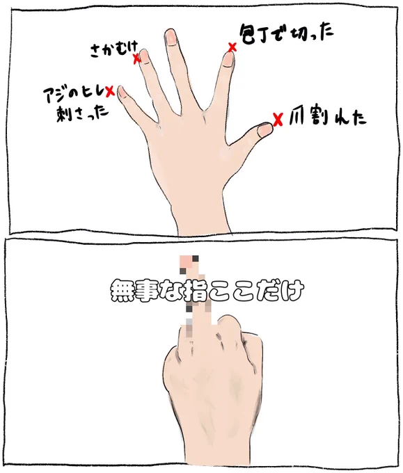 左手がここ1週間ほど災難続き 
