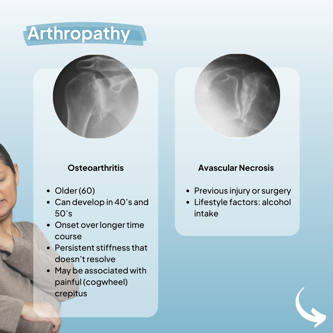 Physio Network (@physionetwork) on Twitter photo 🧐 What can explain loss of shoulder external rotation?
🥶 Frozen shoulder is not the only possible cause.
🍿 Learn more in our brand new 3hr Masterclass on Frozen Shoulder with <a href="/ACadogan_NZ/">Angela Cadogan</a>
✅ Watch it now with our 7-day FREE trial: physio-network.com/masterclass/fr… 🧐 What can explain loss of shoulder external rotation?
🥶 Frozen shoulder is not the only possible cause.
🍿 Learn more in our brand new 3hr Masterclass on Frozen Shoulder with <a href="/ACadogan_NZ/">Angela Cadogan</a>
✅ Watch it now with our 7-day FREE trial: physio-network.com/masterclass/fr…