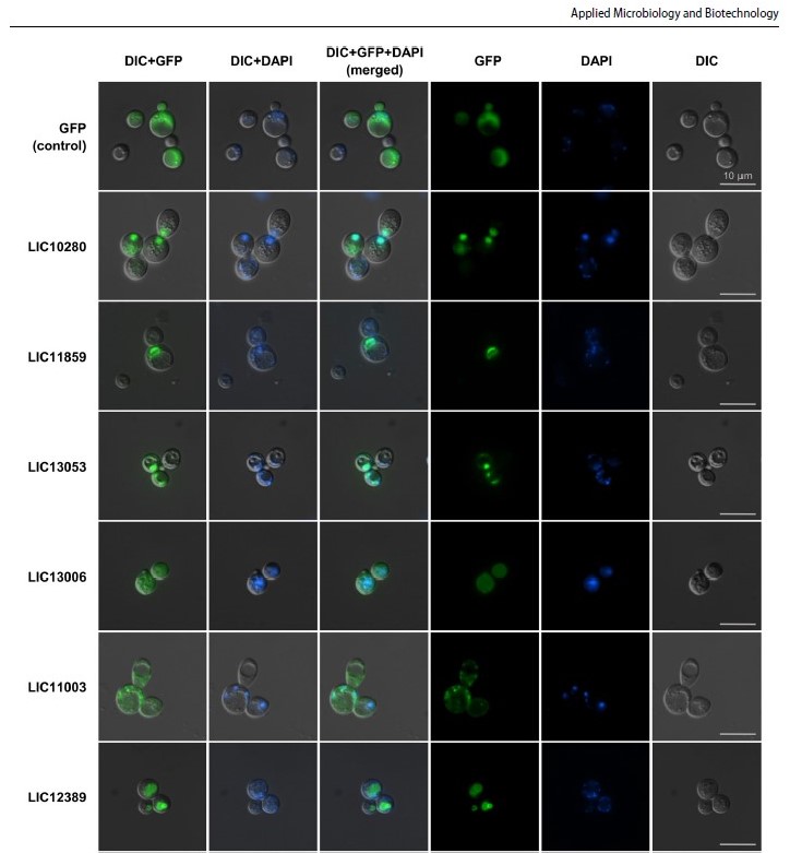Eugene0ng's tweet photo. Excited to share our recent #research article on the screening of Leptospira proteins in yeast, published with @SpringerNature in Appl Microbiol Biotechnol.

https://t.co/FXjM2tNg8N

Check out the cool GFP localisation microscopy. https://t.co/ICPzXYZZdU