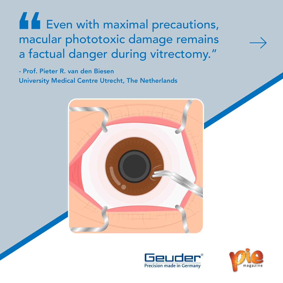 MediaMICEgroup's tweet photo. Laser vitrectomies are blades of light that can save your sight — but there’s a double edge!
Read our newest write up to find out how!
https://t.co/Dm9hweNyM3
#Geuder #SOLEALED #MediaMICE #PIEmagazine #eyesurgery #ophthalmology https://t.co/0K9OhgRqUr