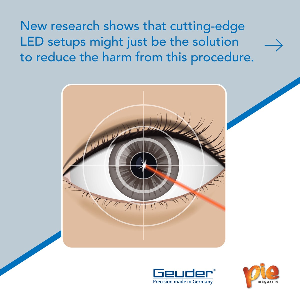 MediaMICEgroup's tweet photo. Laser vitrectomies are blades of light that can save your sight — but there’s a double edge!
Read our newest write up to find out how!
https://t.co/Dm9hweNyM3
#Geuder #SOLEALED #MediaMICE #PIEmagazine #eyesurgery #ophthalmology https://t.co/0K9OhgRqUr